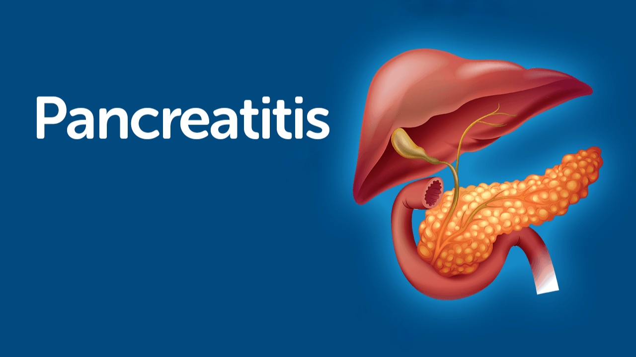 Pancreatitis 1000062213